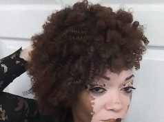 ‘I Feel Like God Has Given Me A Second Chance At Life”, Says Woman Suffering From Vitiligo